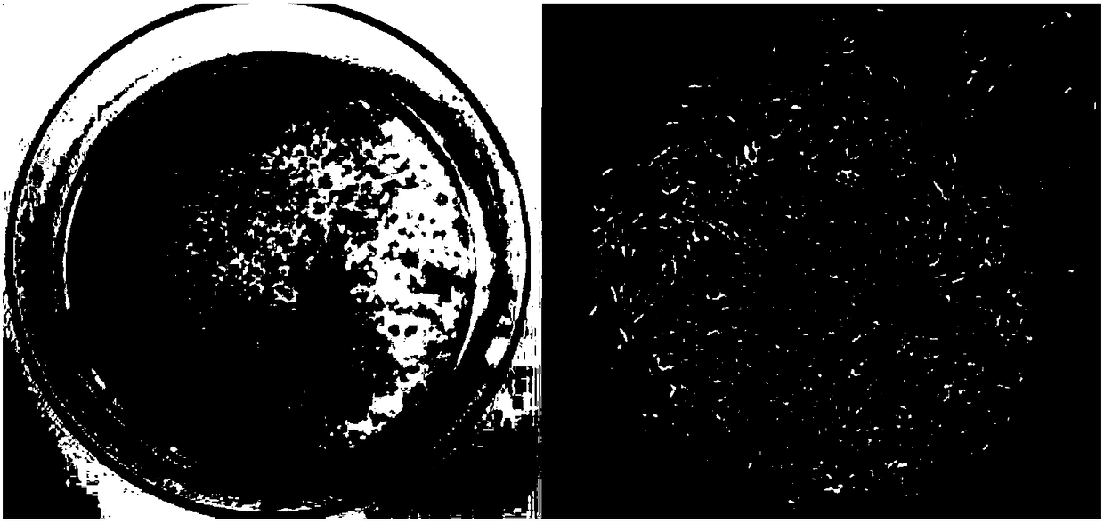 Anti-aging stem cell culture medium and culture method of mesenchymal stem cells