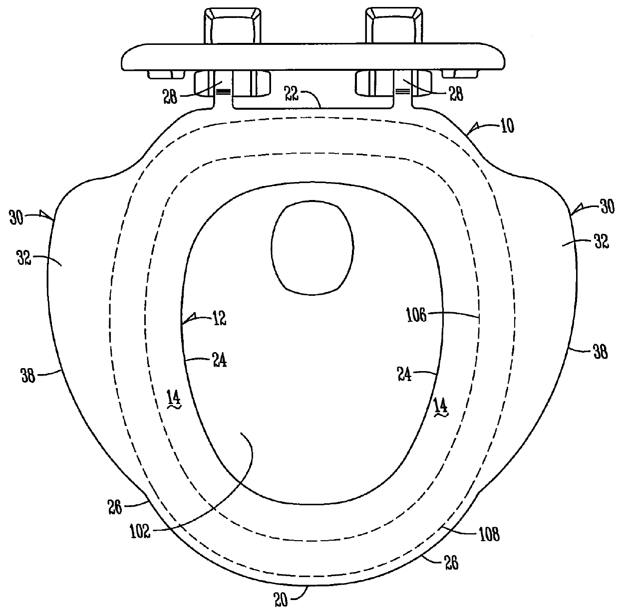 Toilet seat