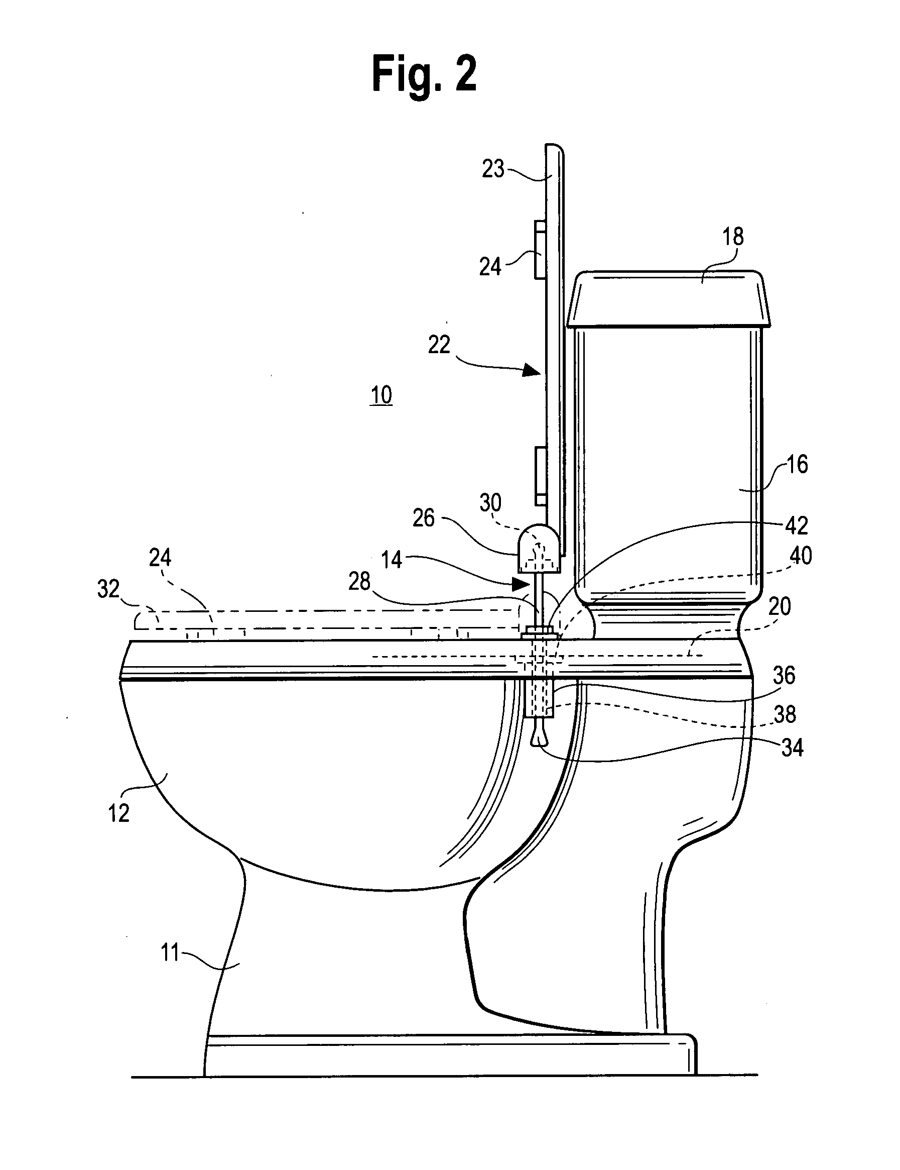 Toilet and toilet seat mounting system