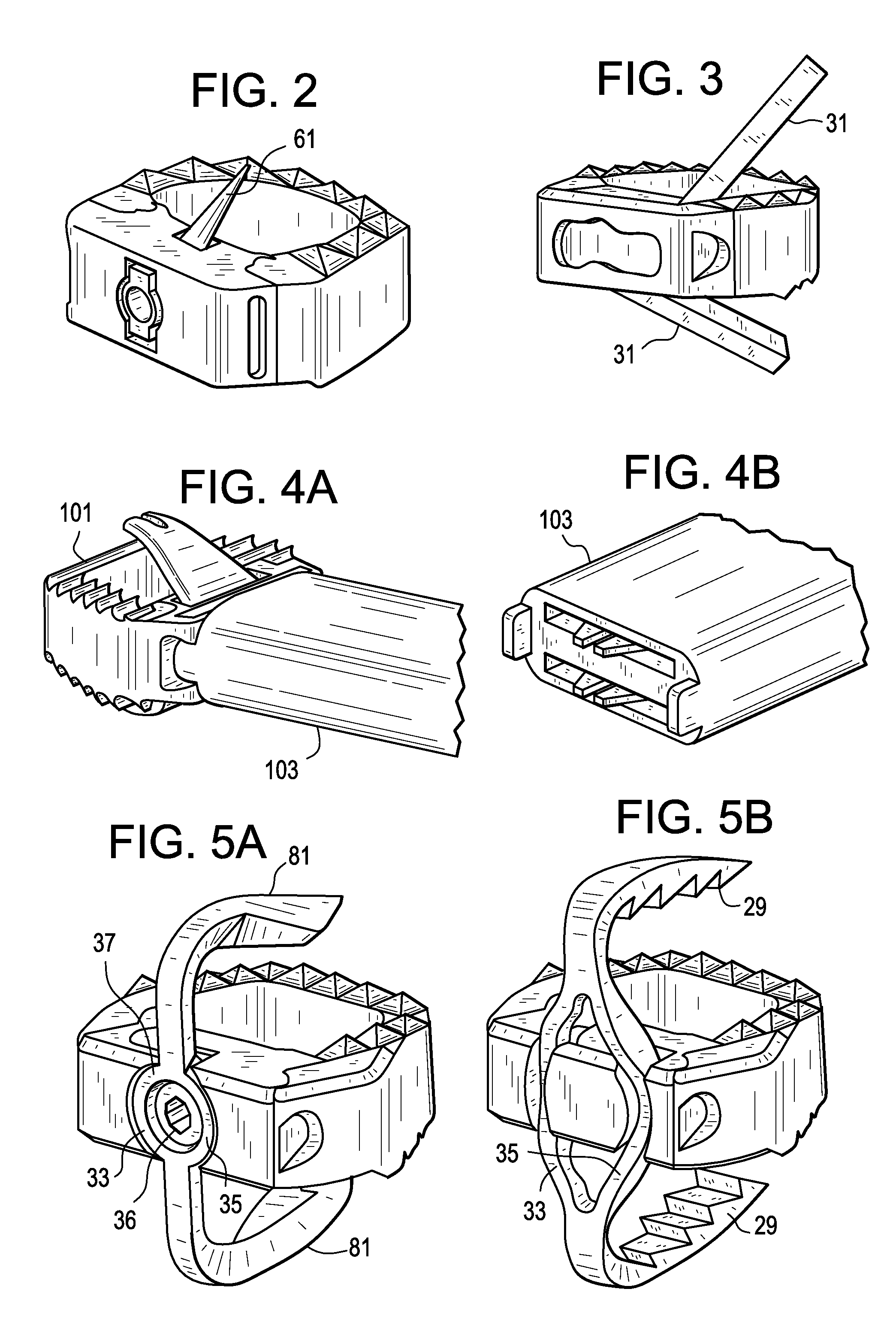 Fusion cage with in-line single piece fixation