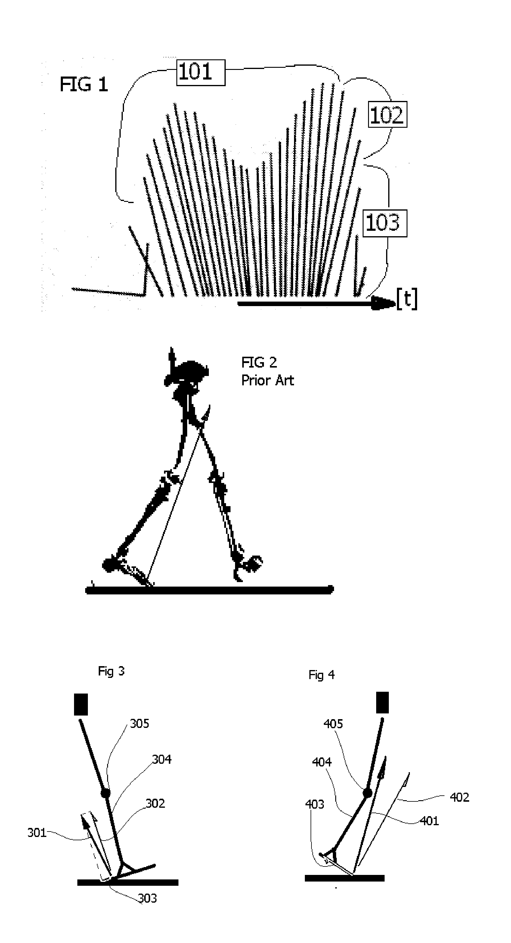 Prosthesis having movement lock