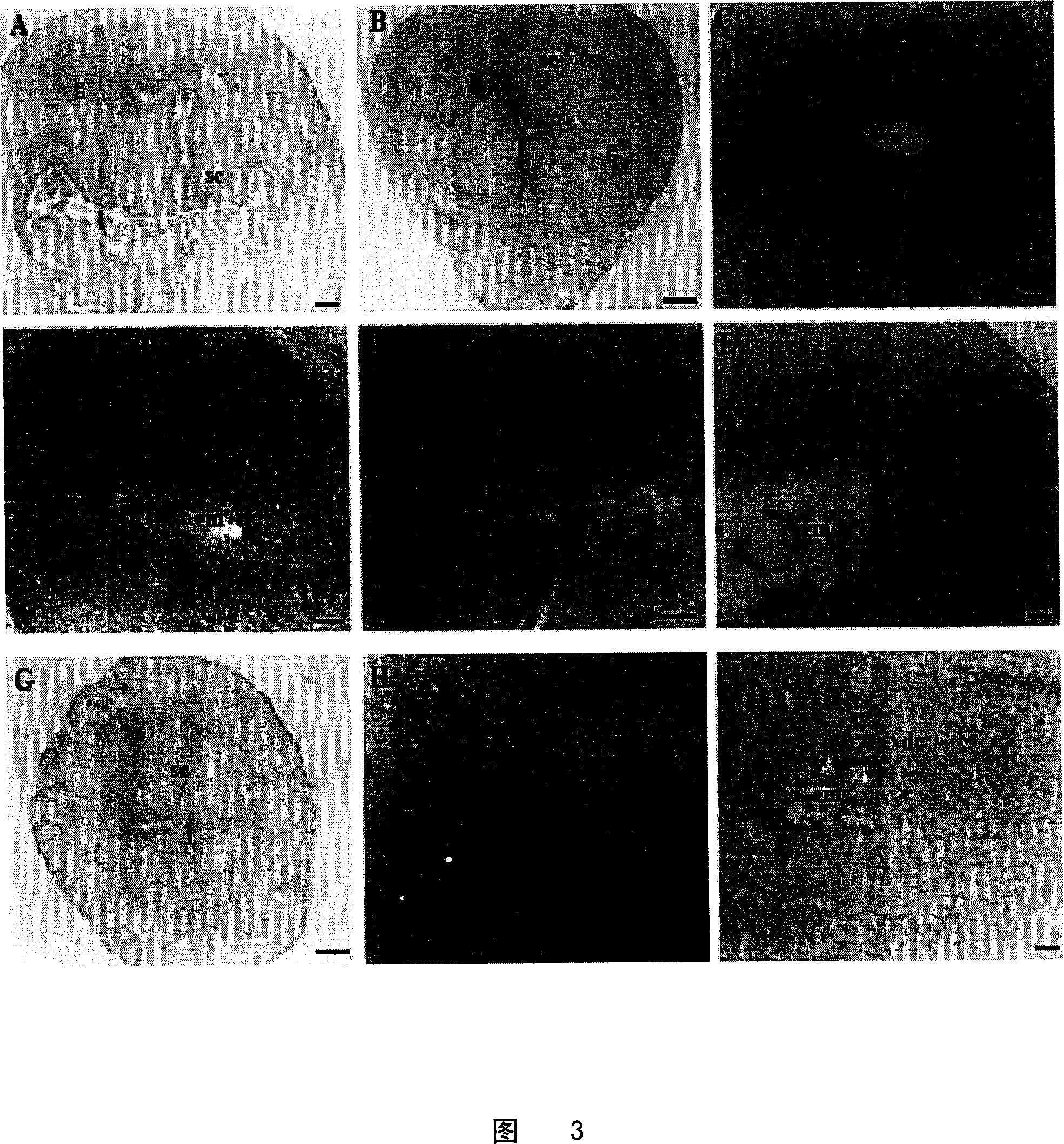 Function of E4BP4 gene inplantation course and use thereof