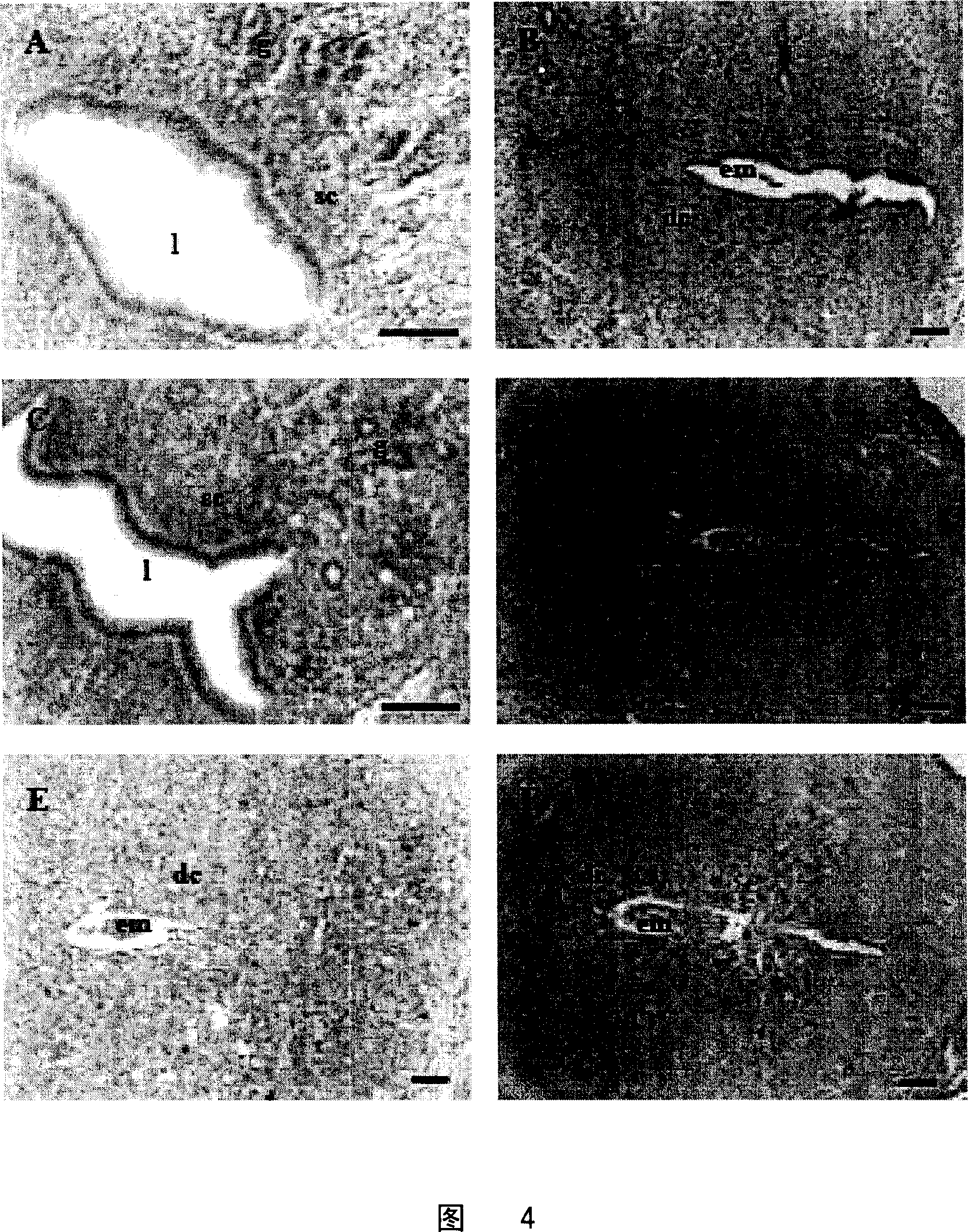 Function of E4BP4 gene inplantation course and use thereof