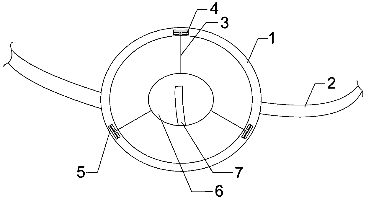 Embedded stoma device