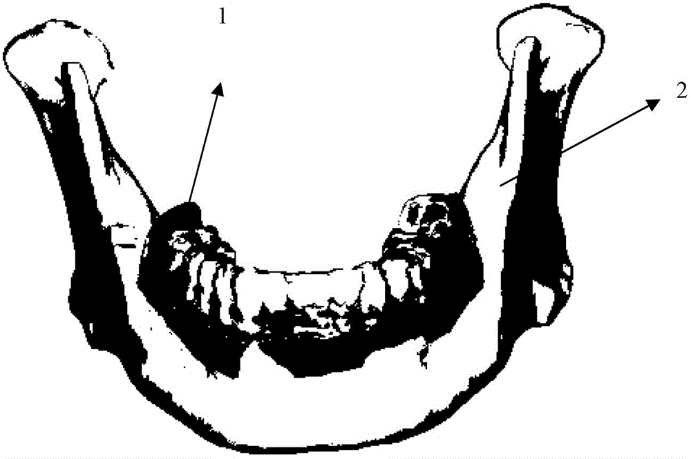 Individuation orthodontic method based on shape memory polymer arch wire