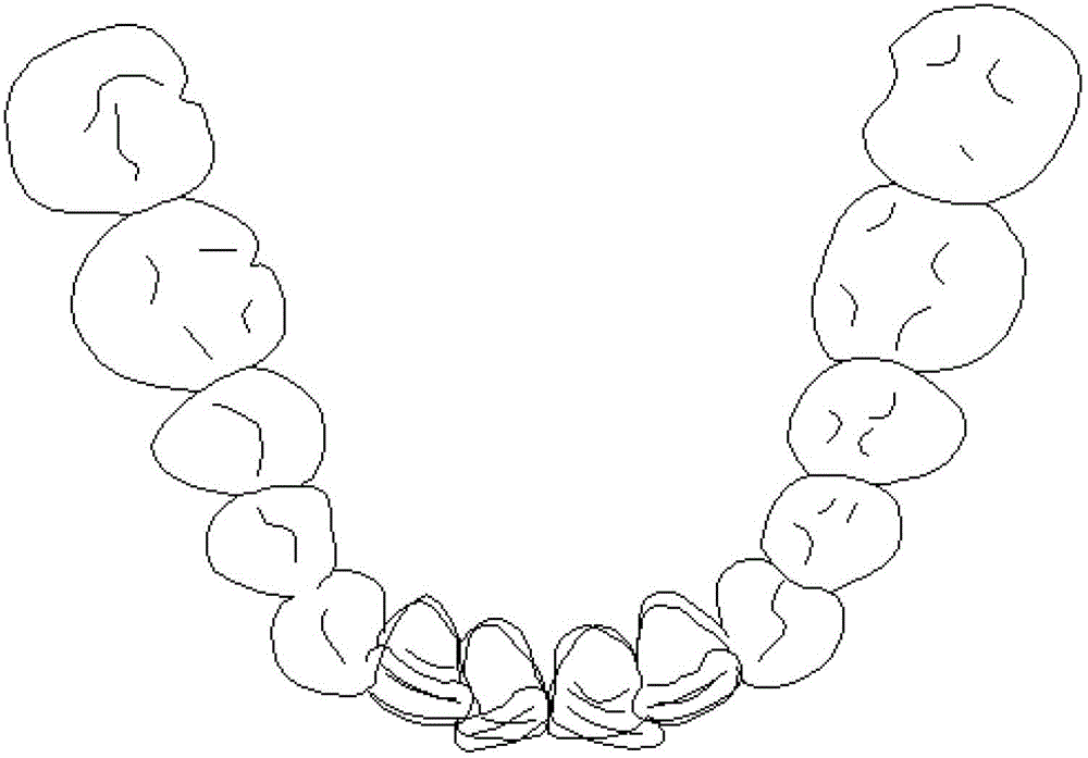 Individuation orthodontic method based on shape memory polymer arch wire