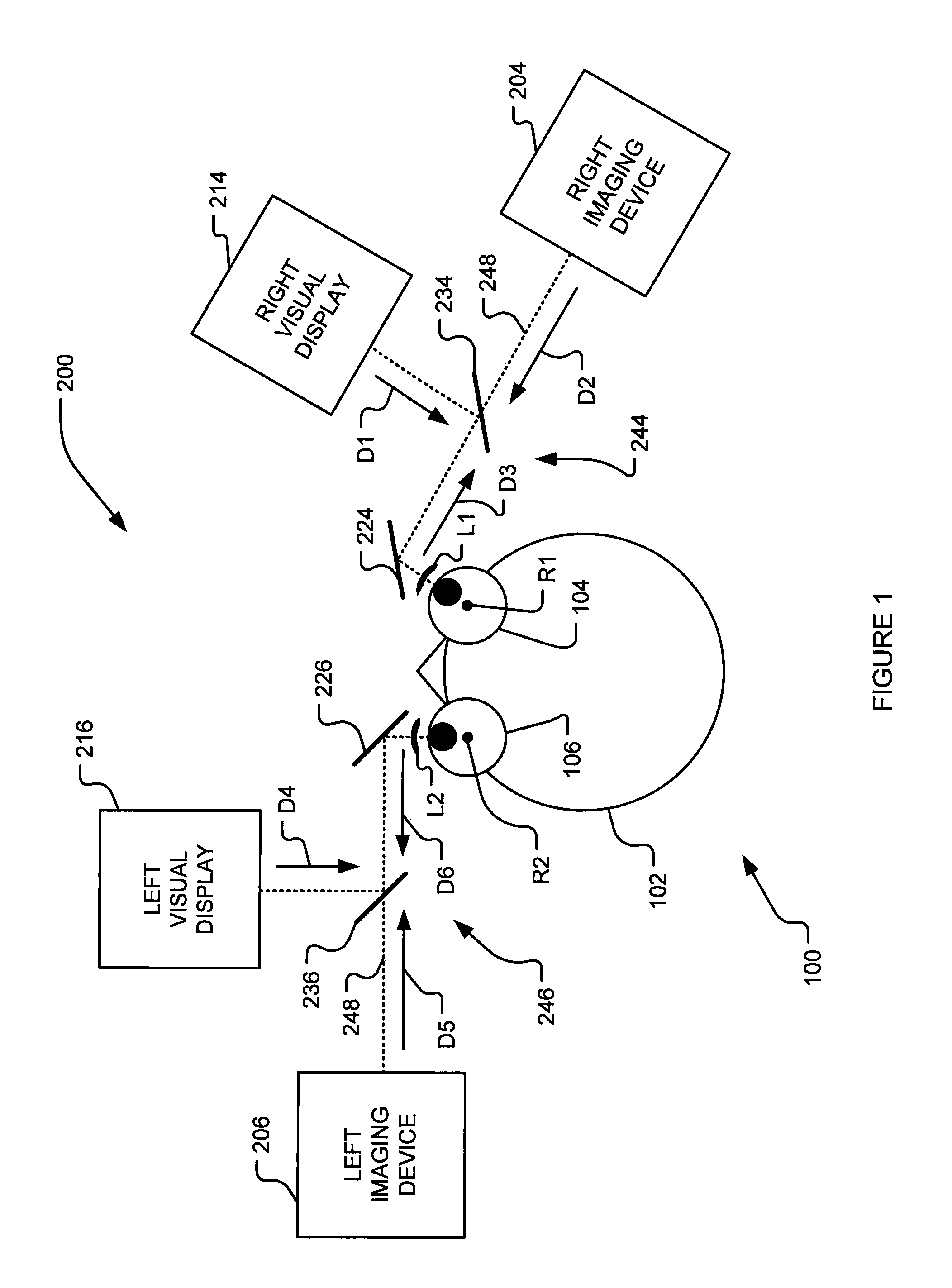 Method and system for treating binocular anomalies