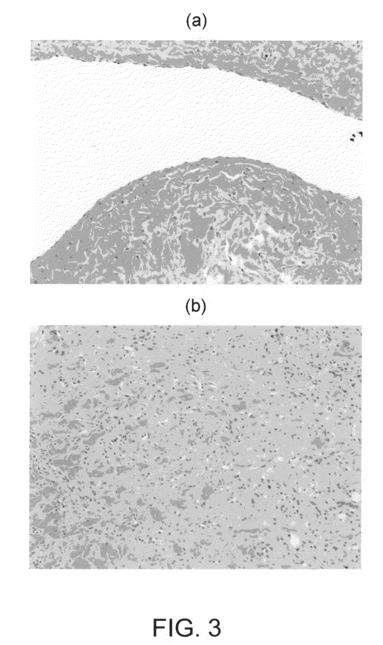 Articles and methods of treating vascular conditions