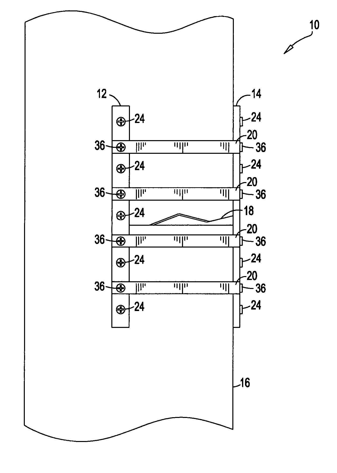 Device for treatment of orthopedic fractures