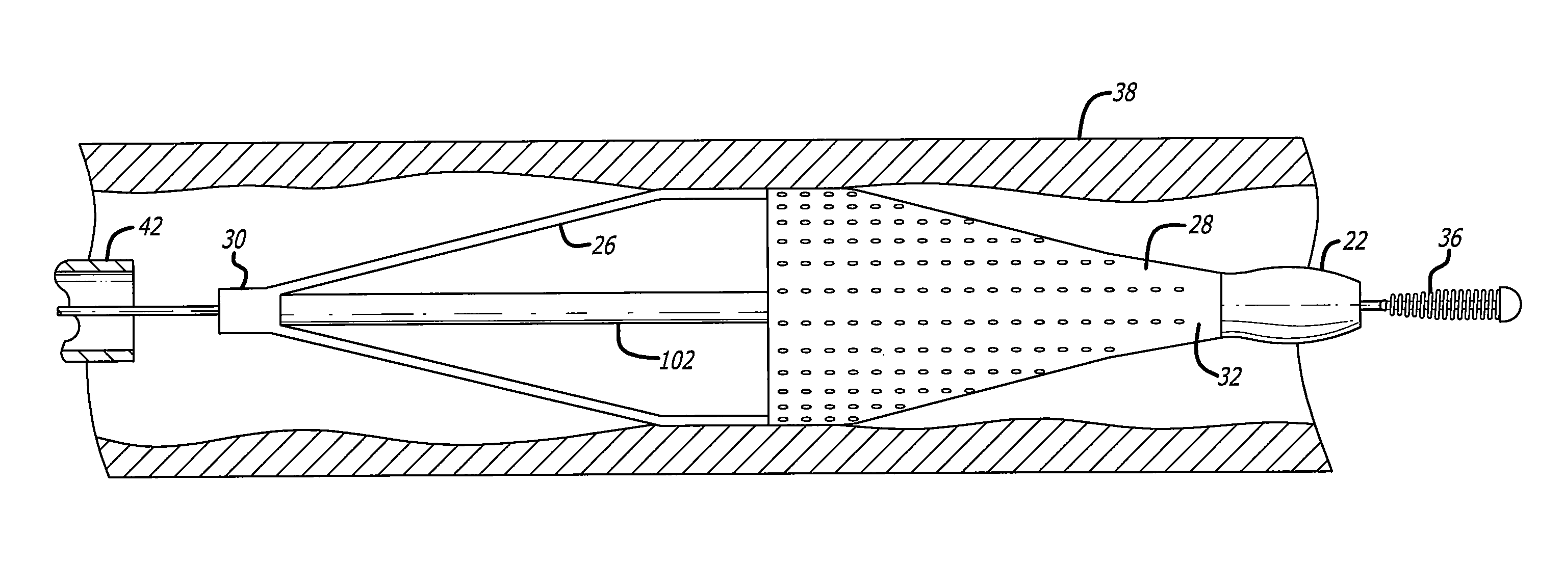 Component for delivering and locking a medical device to a guide wire