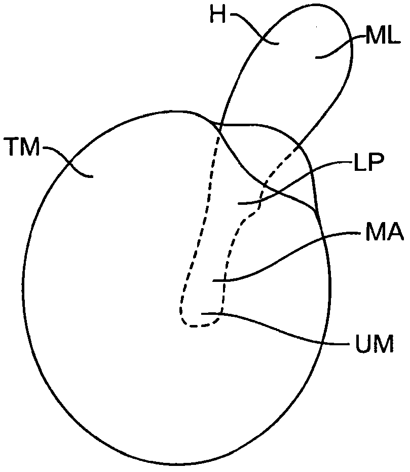 Balanced armature device and method for hearing