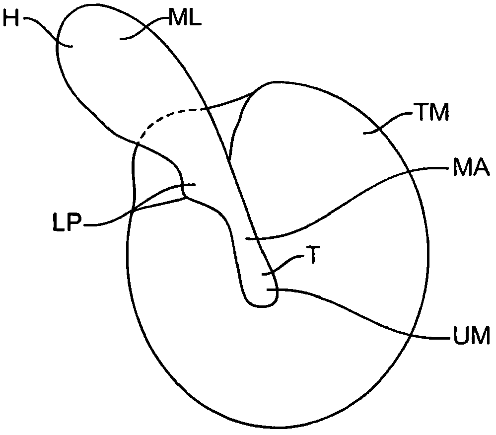 Balanced armature device and method for hearing