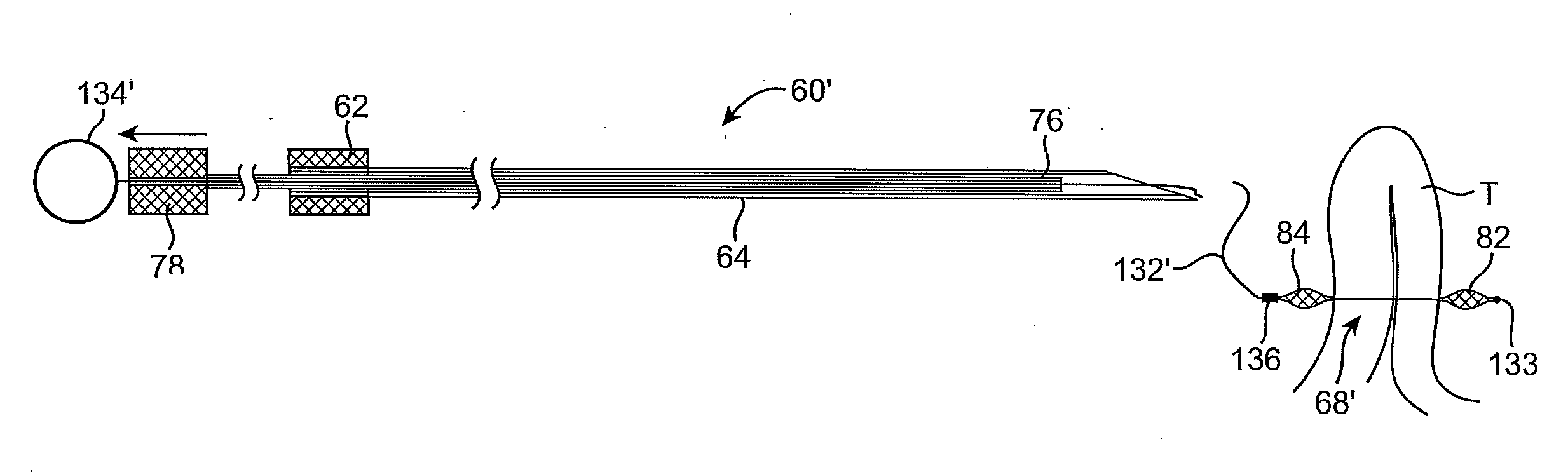 Methods and apparatus for securing and deploying tissue anchors