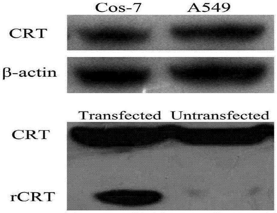 Preparation and application of tumor marker calreticulin detection kit