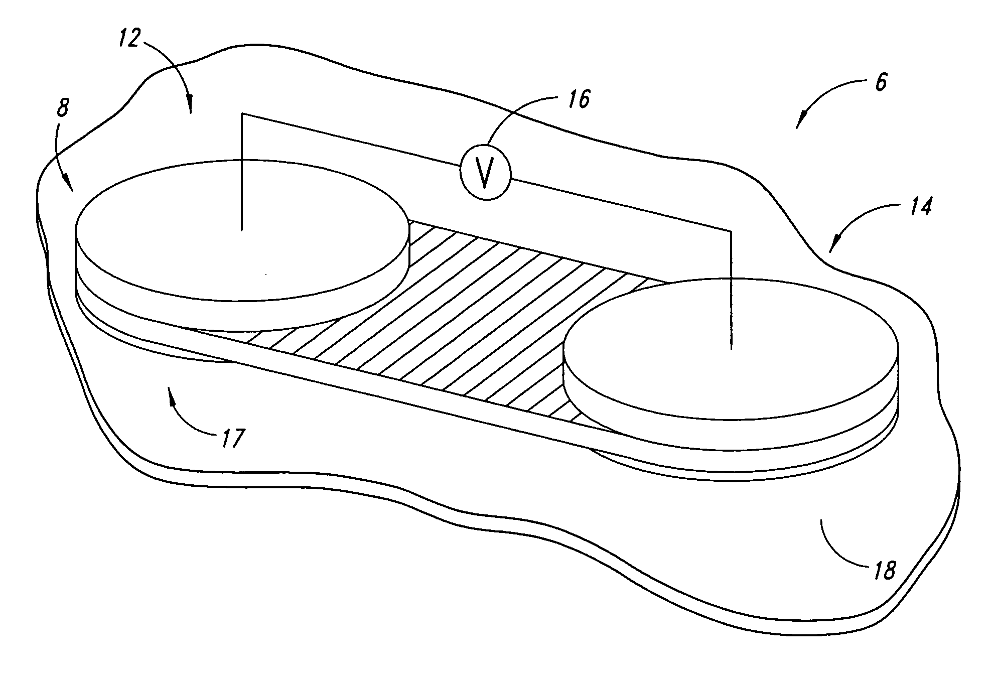 Iontophoresis apparatus and method for the diagnosis of tuberculosis