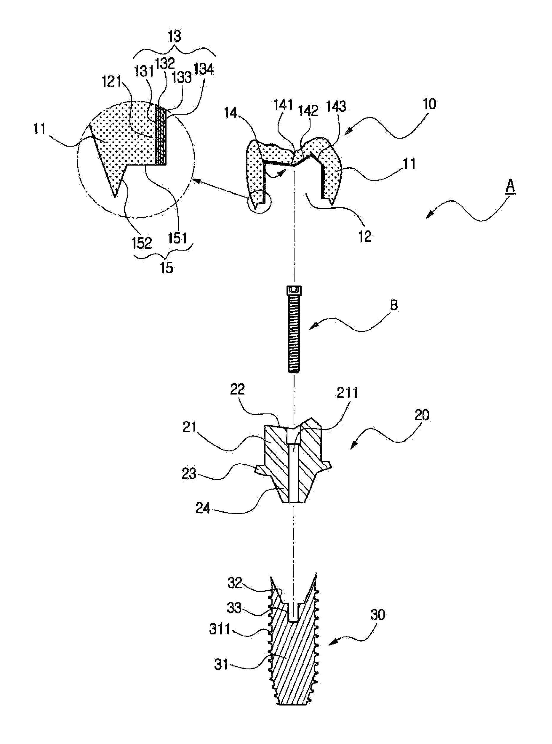 Functional implant