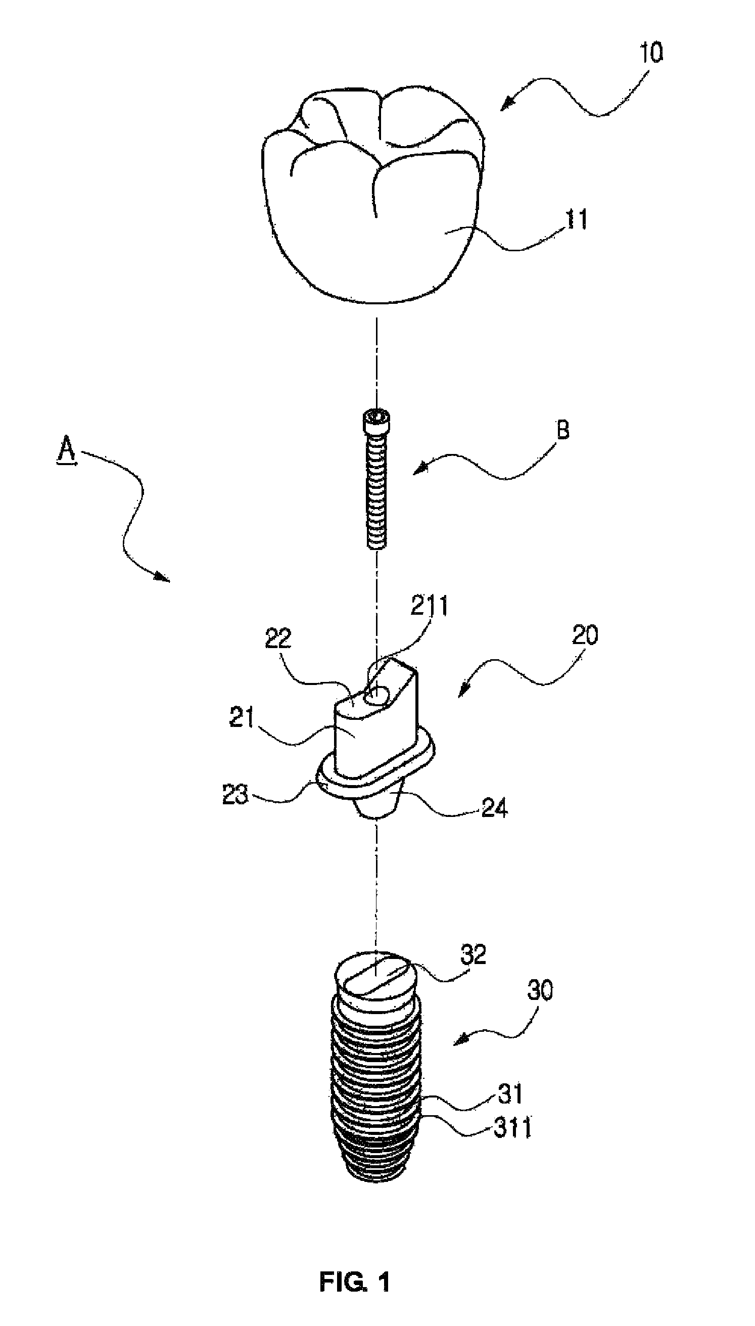 Functional implant