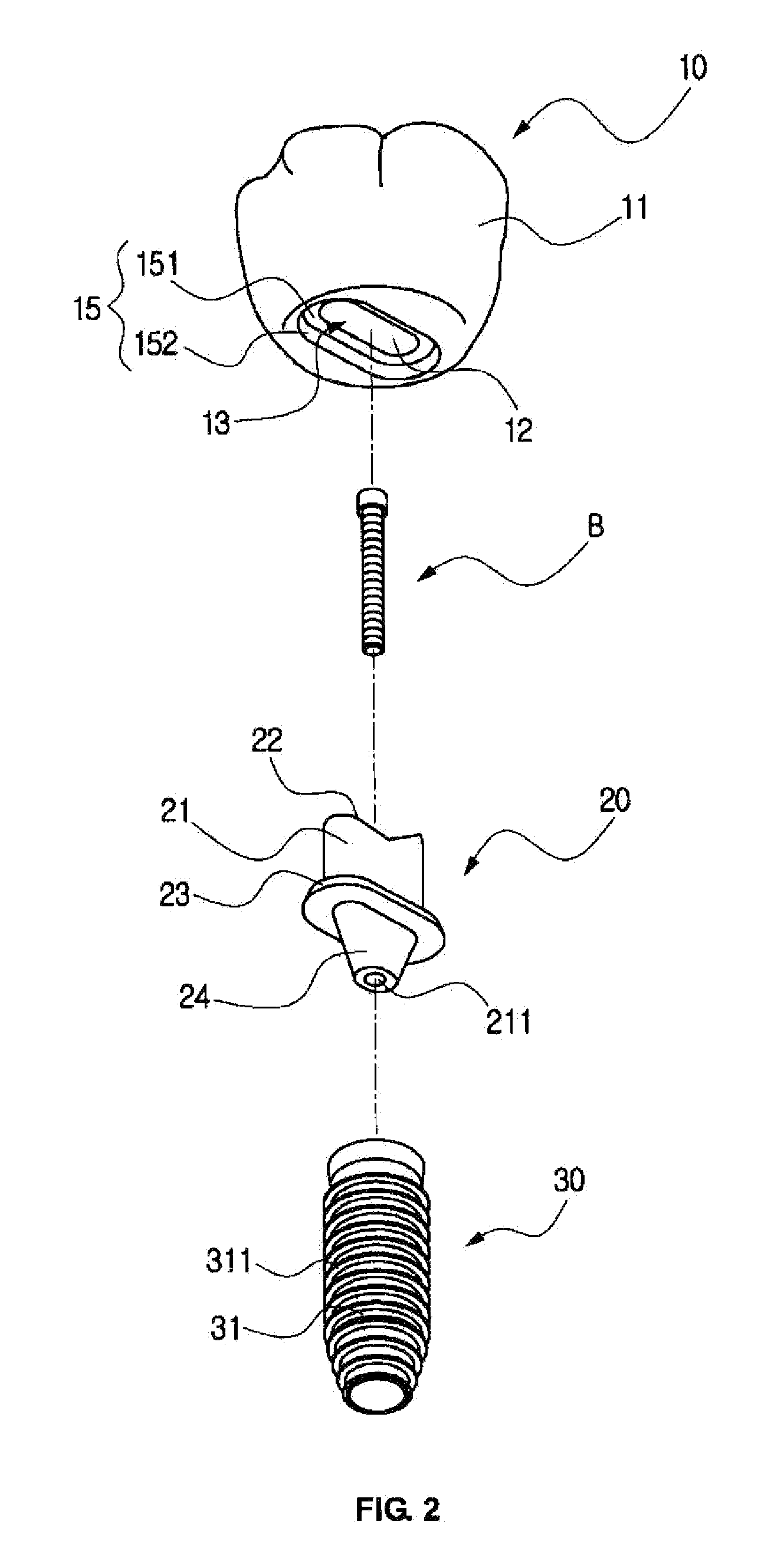 Functional implant