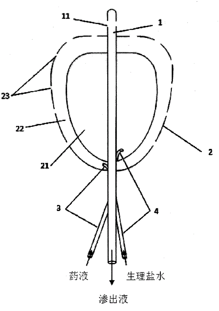 Medicine application device for controlling intrauterine adhesion