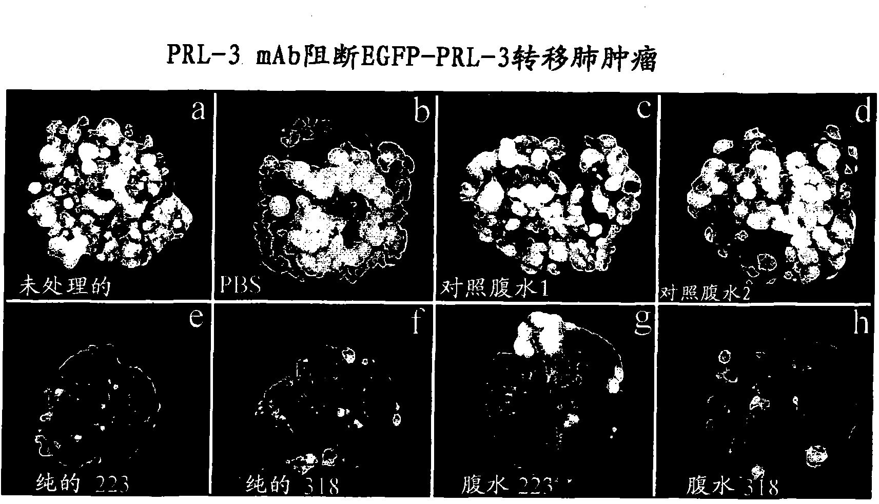 Antibodies binding to an intracellular prl-1 or prl-3 polypeptide