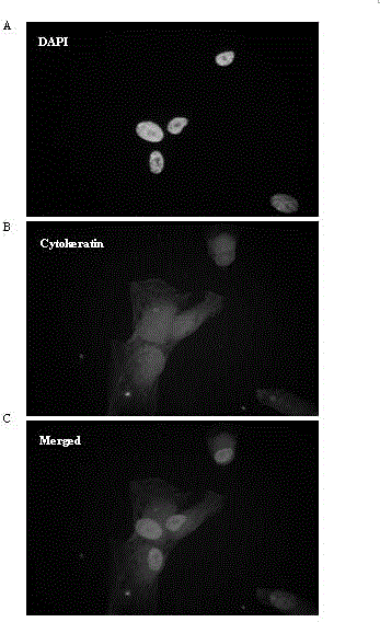 Separation and culture method for different cellular components of human mammary tissue