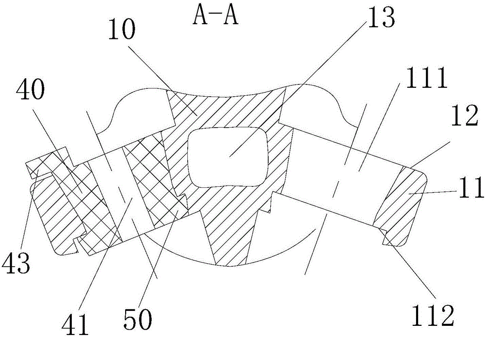 Artificial vertebral body fixing system