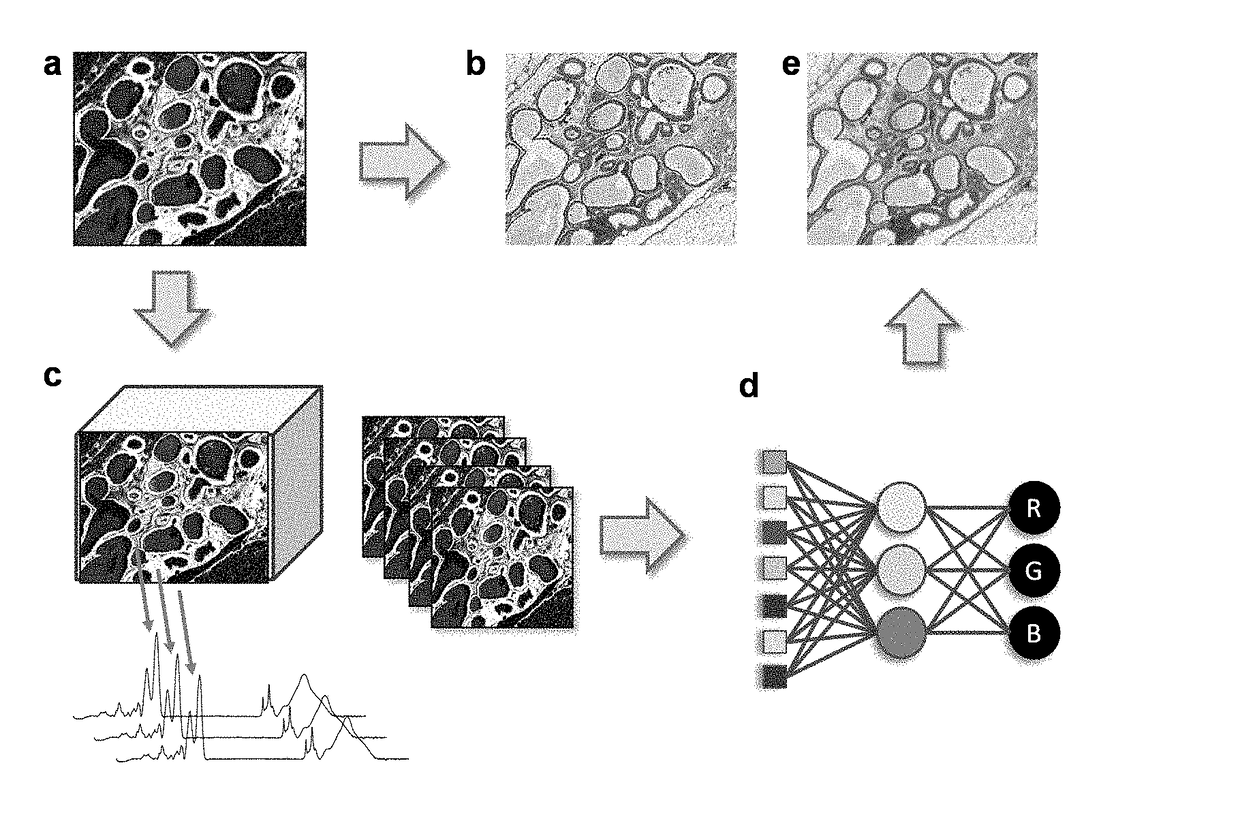 Stain-free histopathology by chemical imaging