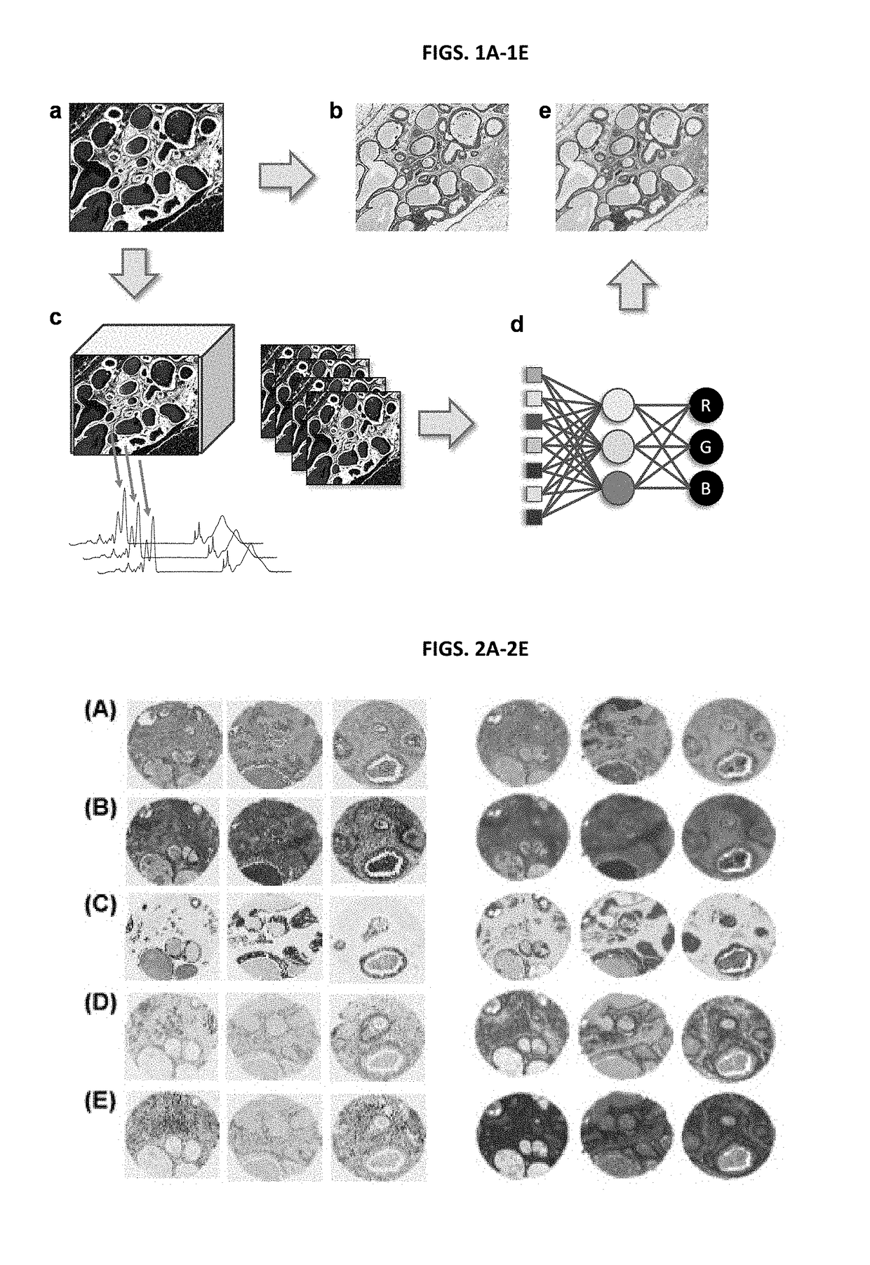 Stain-free histopathology by chemical imaging