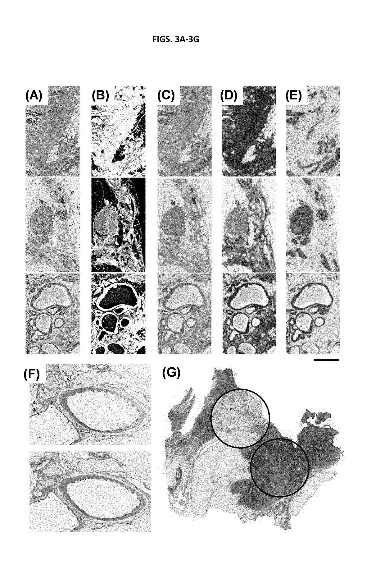 Stain-free histopathology by chemical imaging