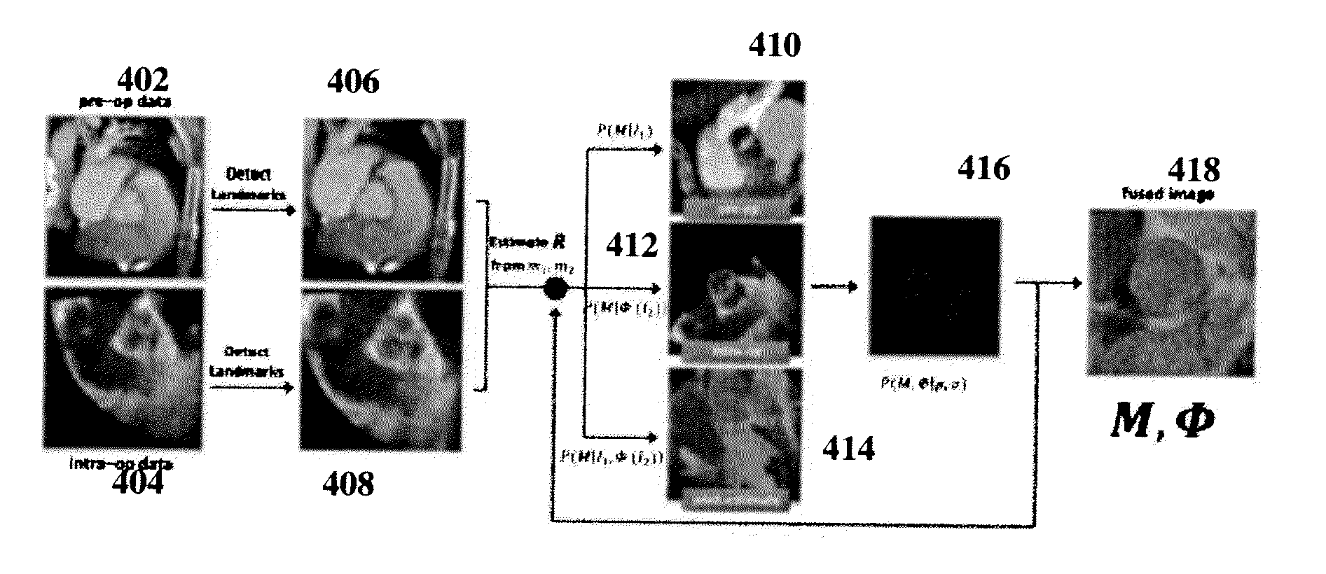 Method and System for Model-Based Fusion of Multi-Modal Volumetric Images