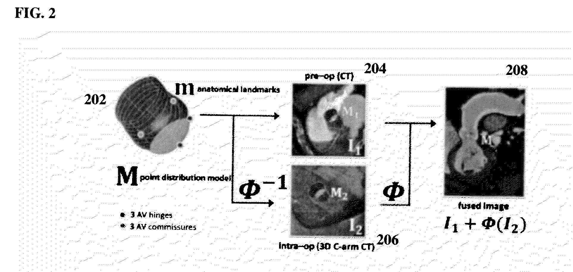 Method and System for Model-Based Fusion of Multi-Modal Volumetric Images