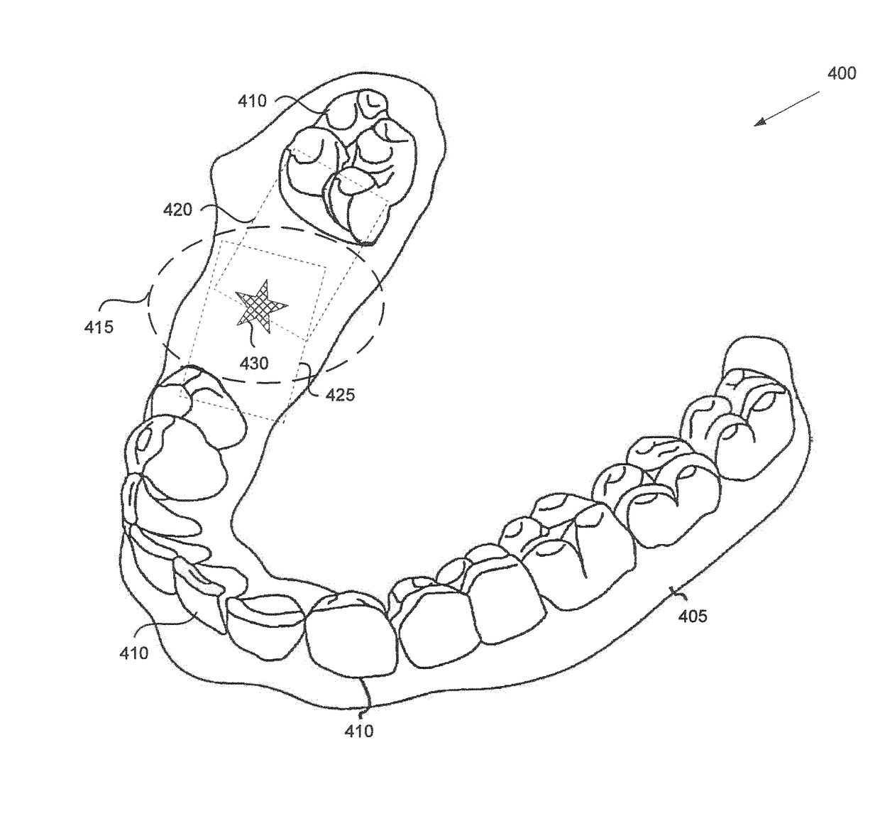 Adhesive objects for improving image registration of intraoral images