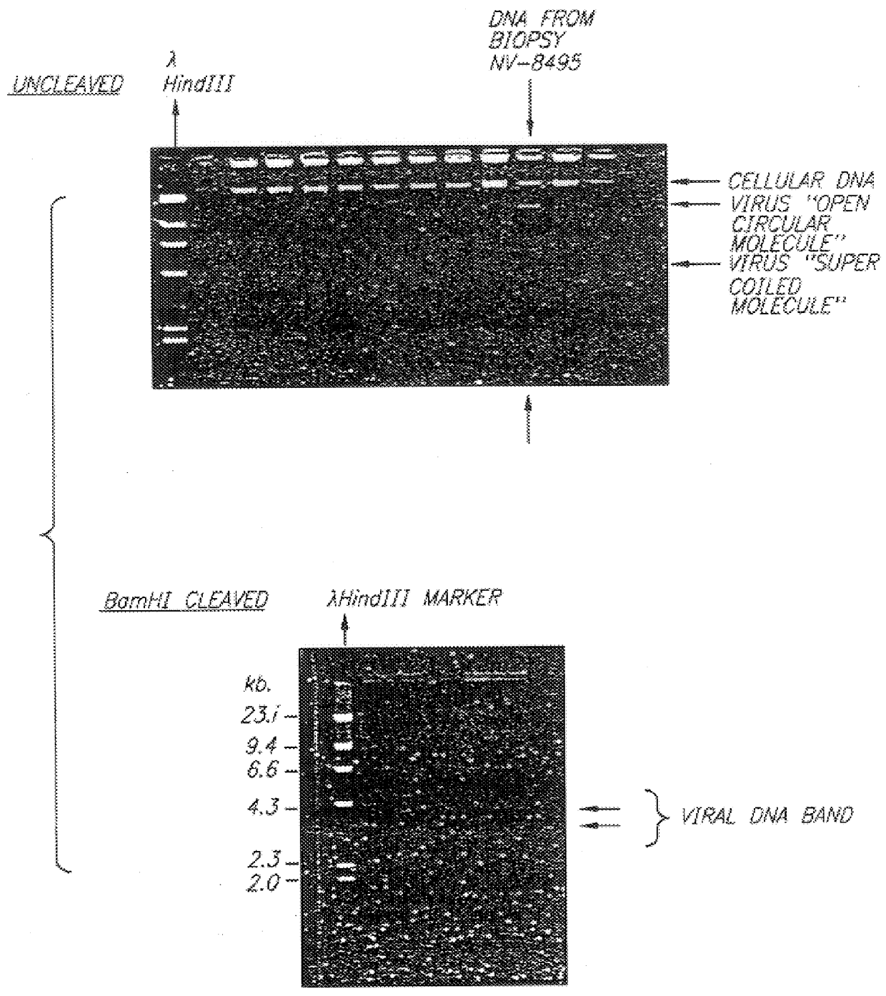 DNA coding for a peptide of a papilloma virus main capside protein and use thereof