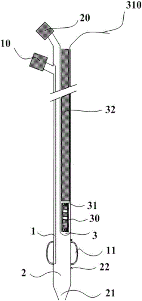 Balloon catheter applied to portal vein