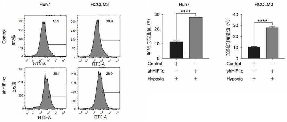 Application of SLC7A11 gene in hepatocellular carcinoma interventional embolization post operation