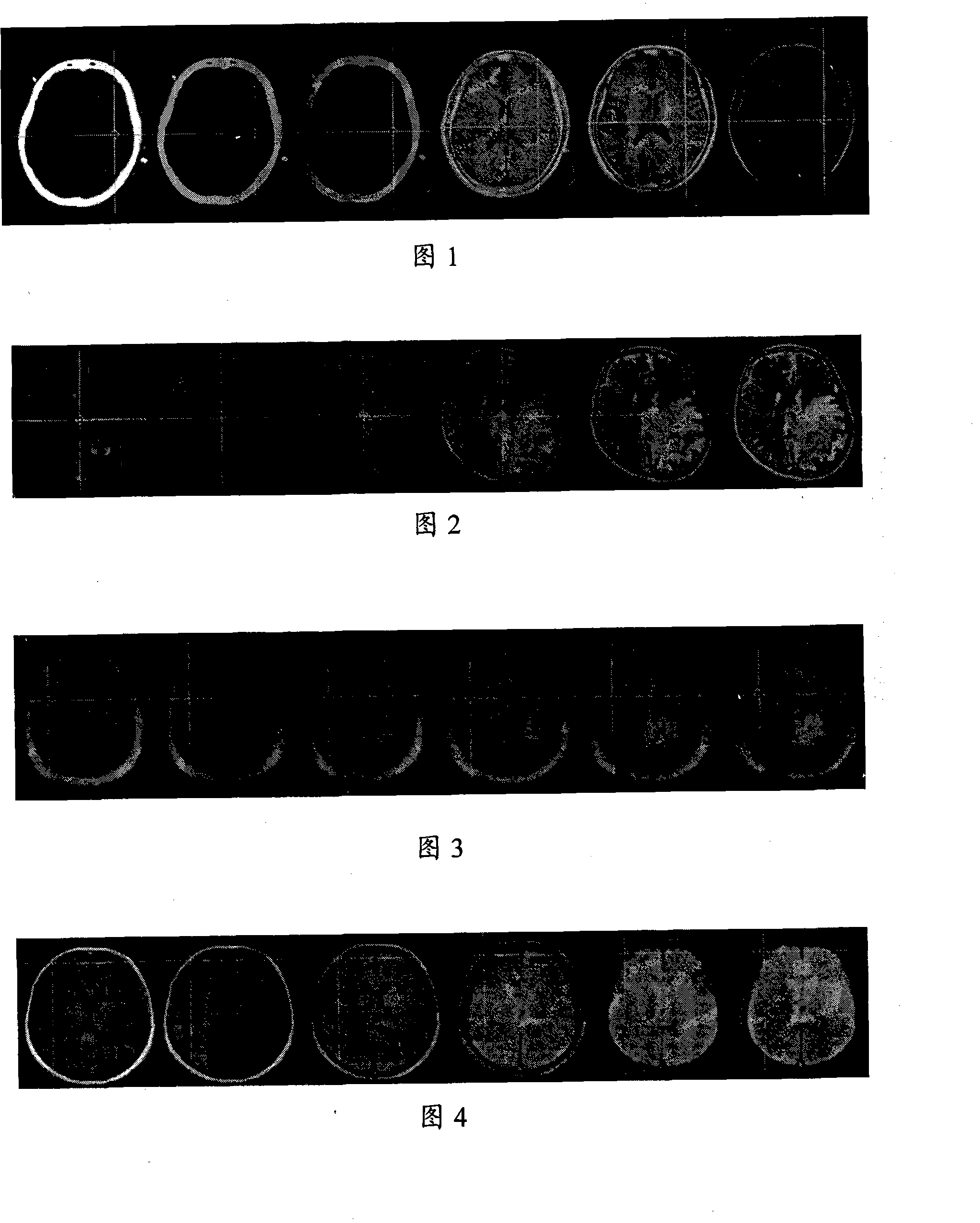 Method for acquiring nerve navigation system imaging data