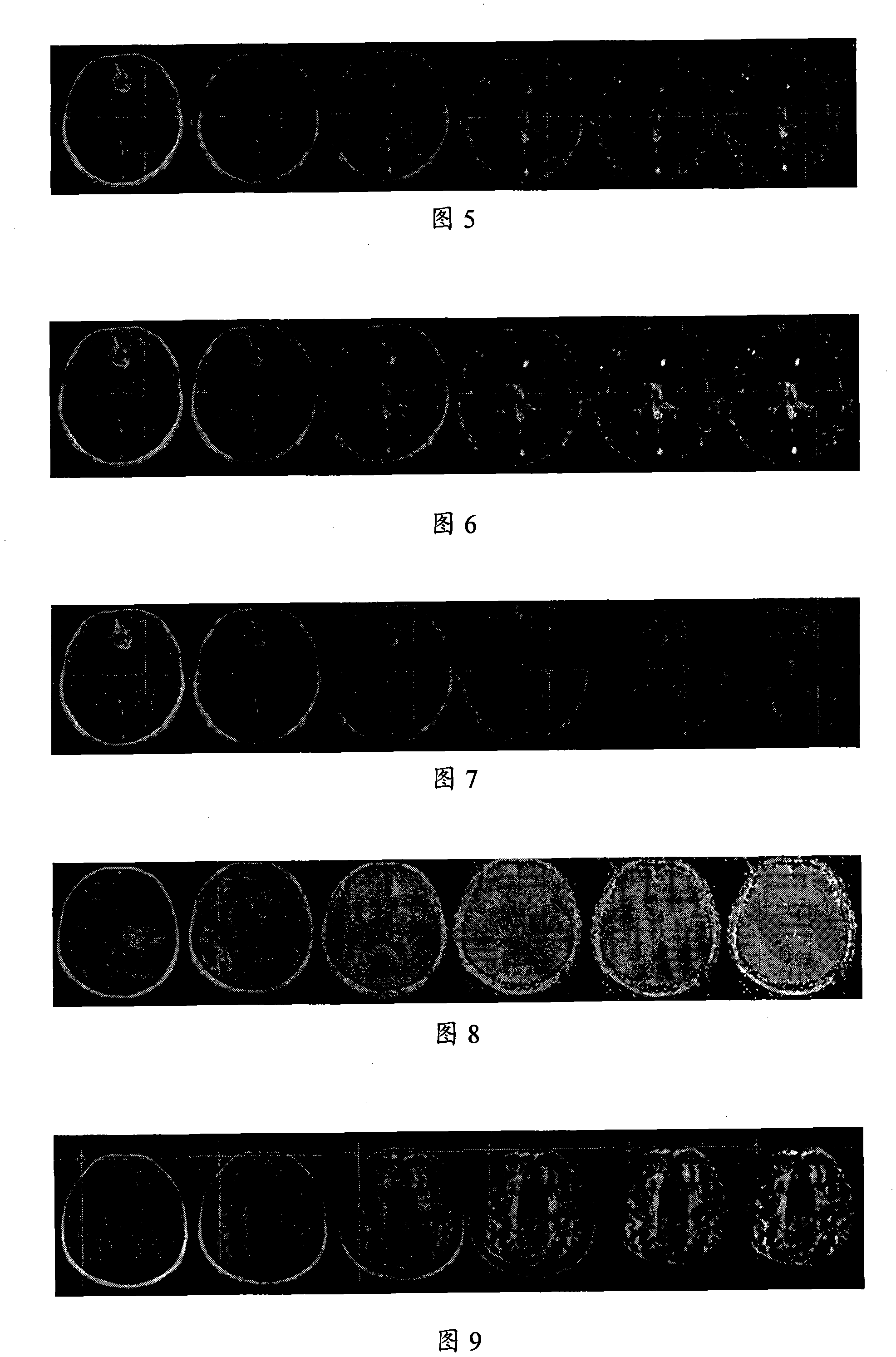 Method for acquiring nerve navigation system imaging data