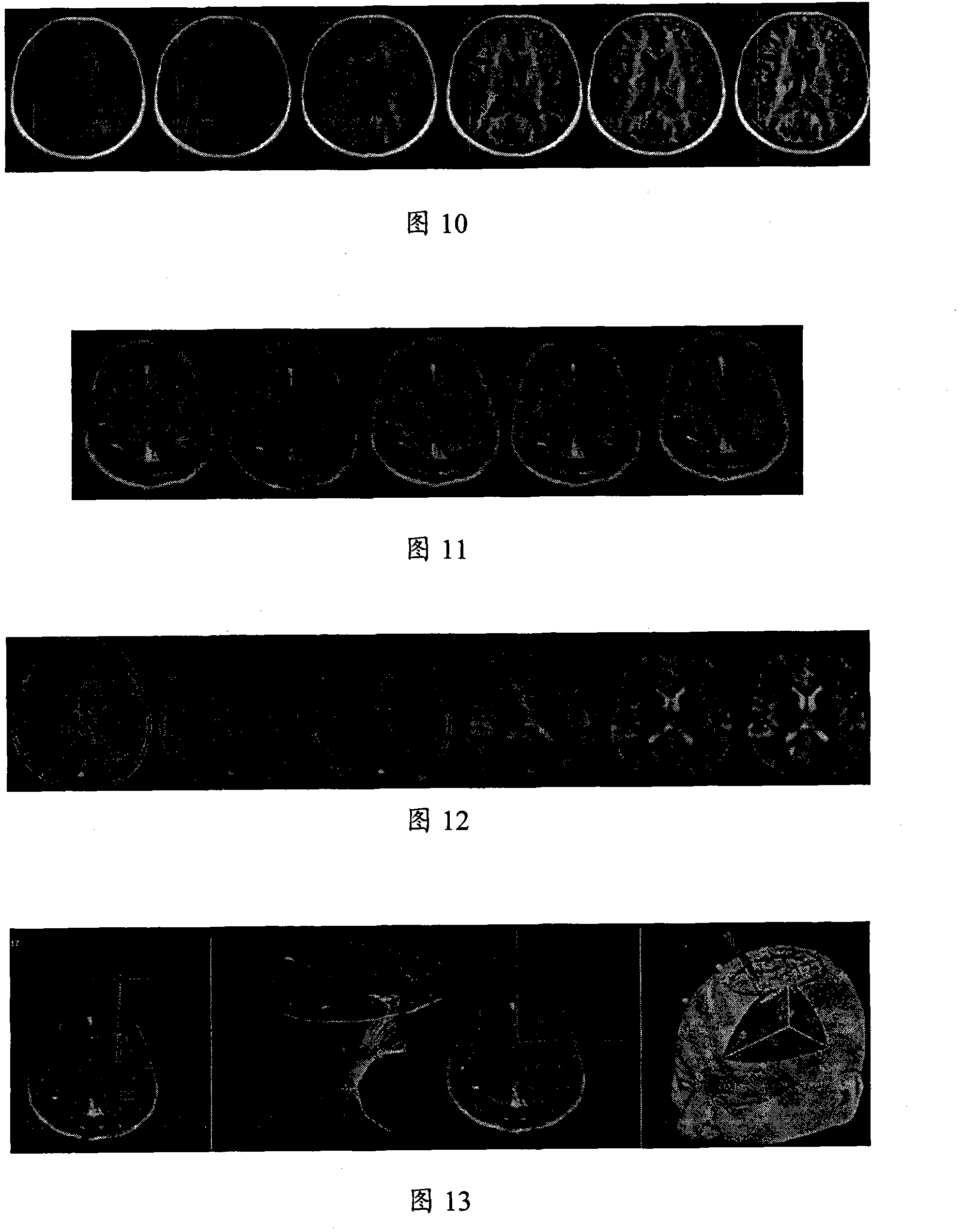 Method for acquiring nerve navigation system imaging data