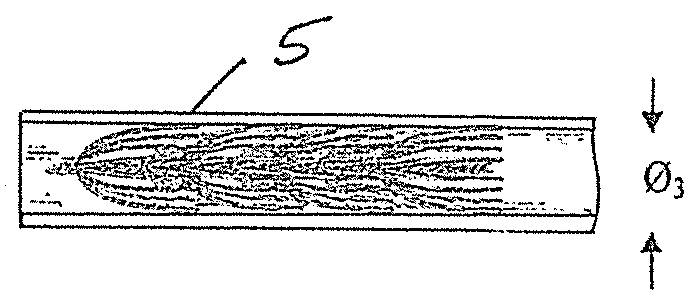 Embolisation systems