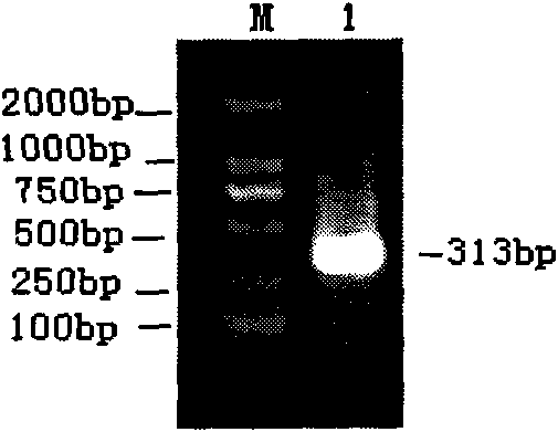 Dual SYBR Green I real-time fluorescence PCR detection primer and method for porcine parvovirus and porcine circovirus type 2