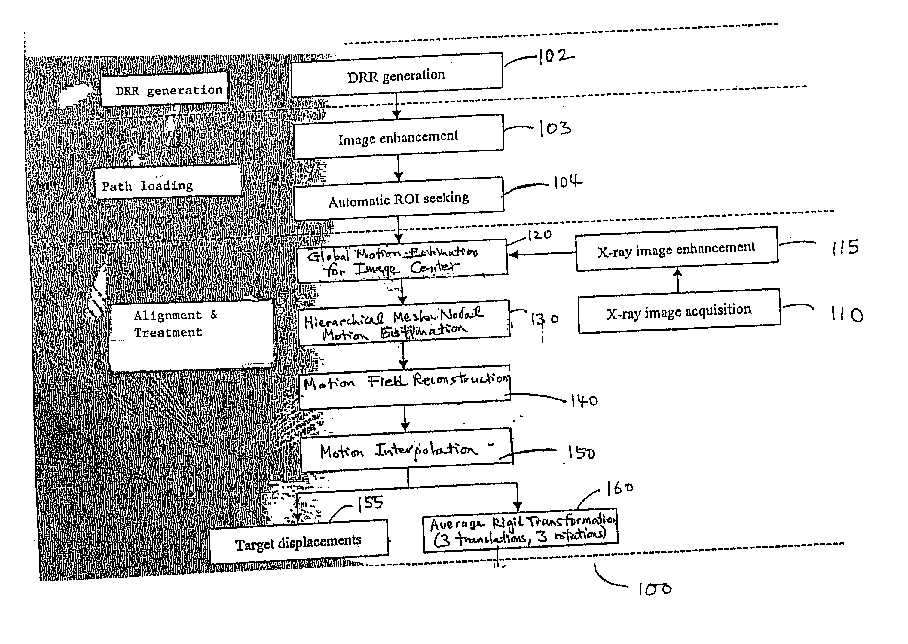 ROI selection in image registration