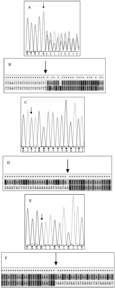 Genetic novel mutations related with phenotype of neonatal low muscular tension and detection kit