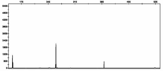 Primers, probe and method for detecting various respiratory viruses