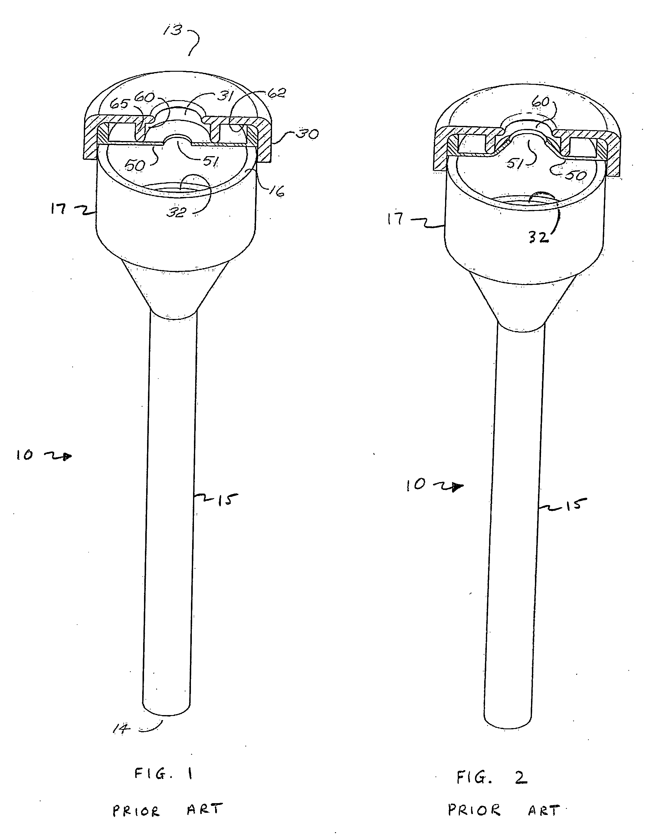 Seal housing having anti-inversion features