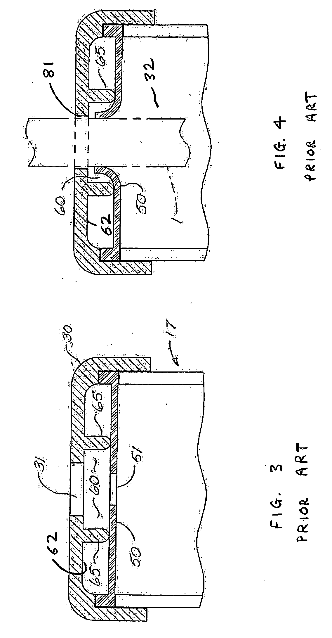 Seal housing having anti-inversion features