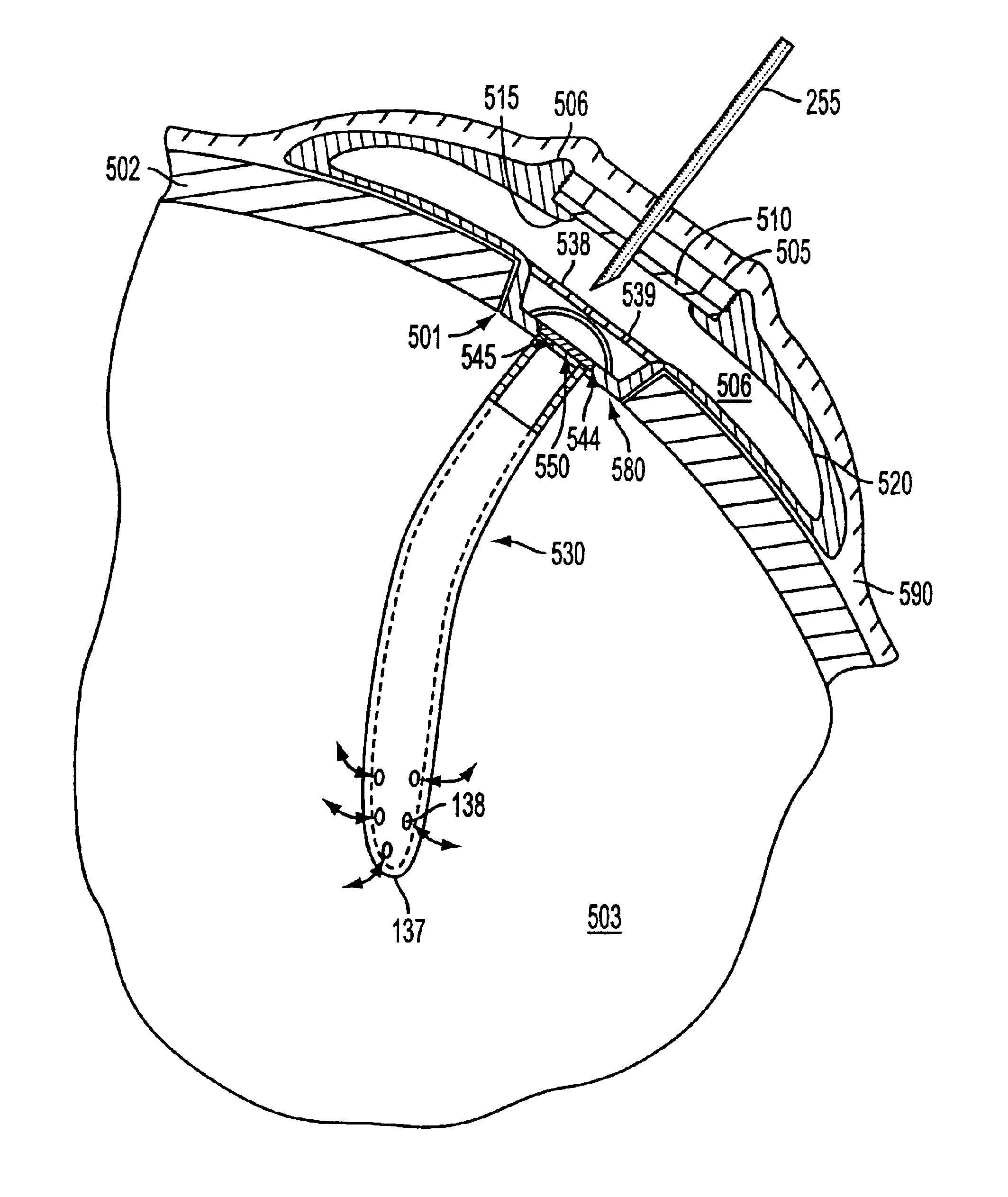 Implantable refillable and ported controlled release drug delivery device