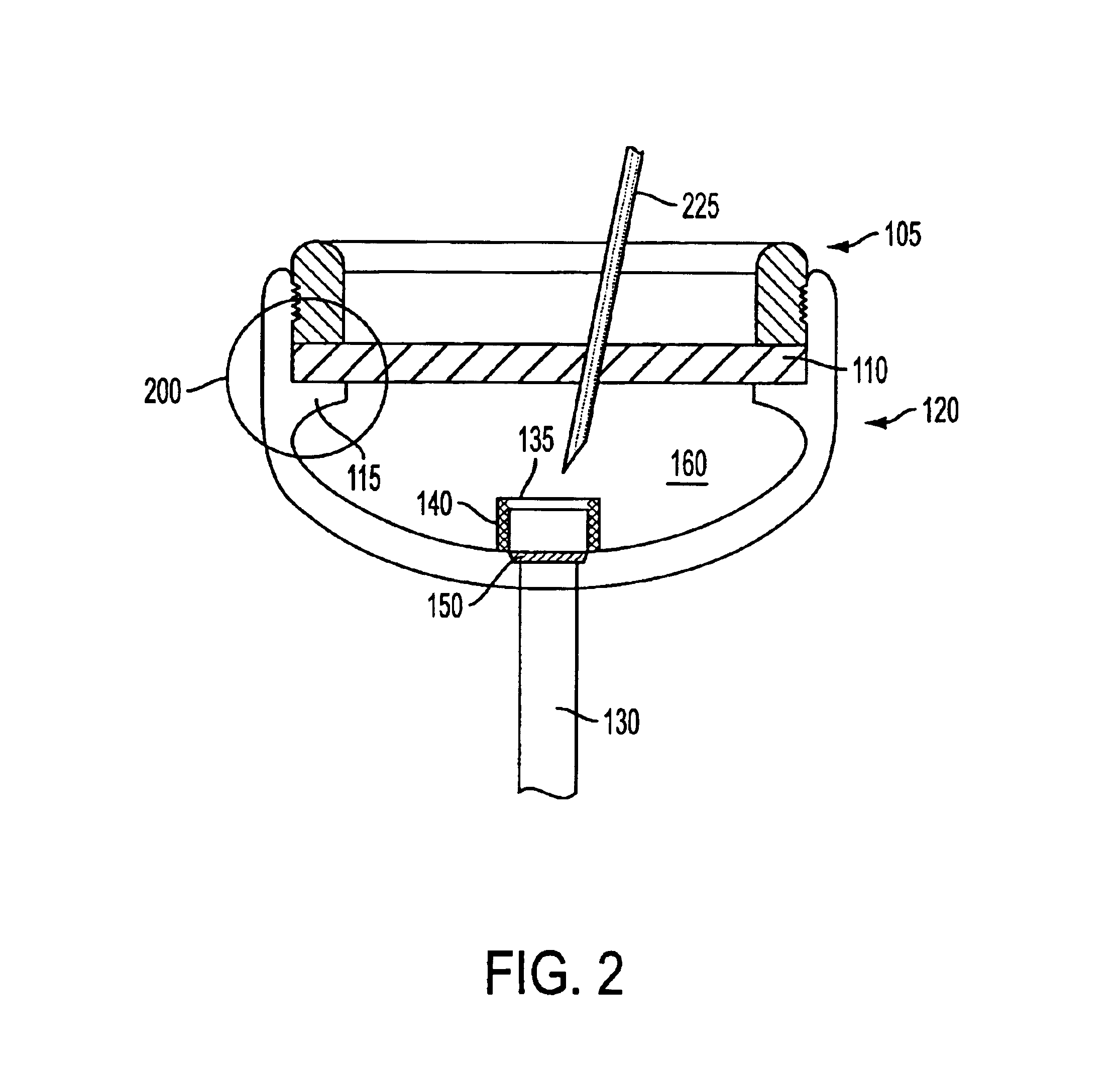 Implantable refillable and ported controlled release drug delivery device