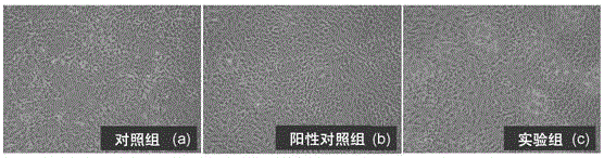 Method for improving osteogenic differentiation efficiency of human amniotic mesenchymal stem cells and application thereof