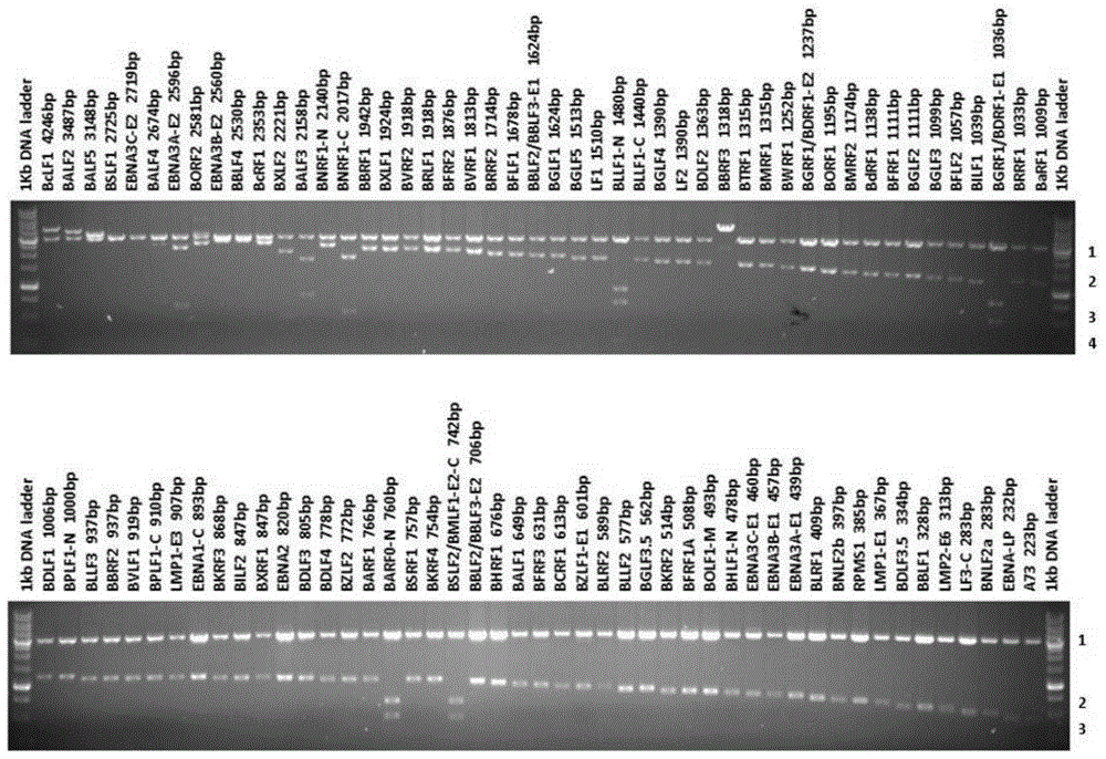 Nasopharyngeal carcinoma EB virus serum antibody tag detection chip and kit thereof