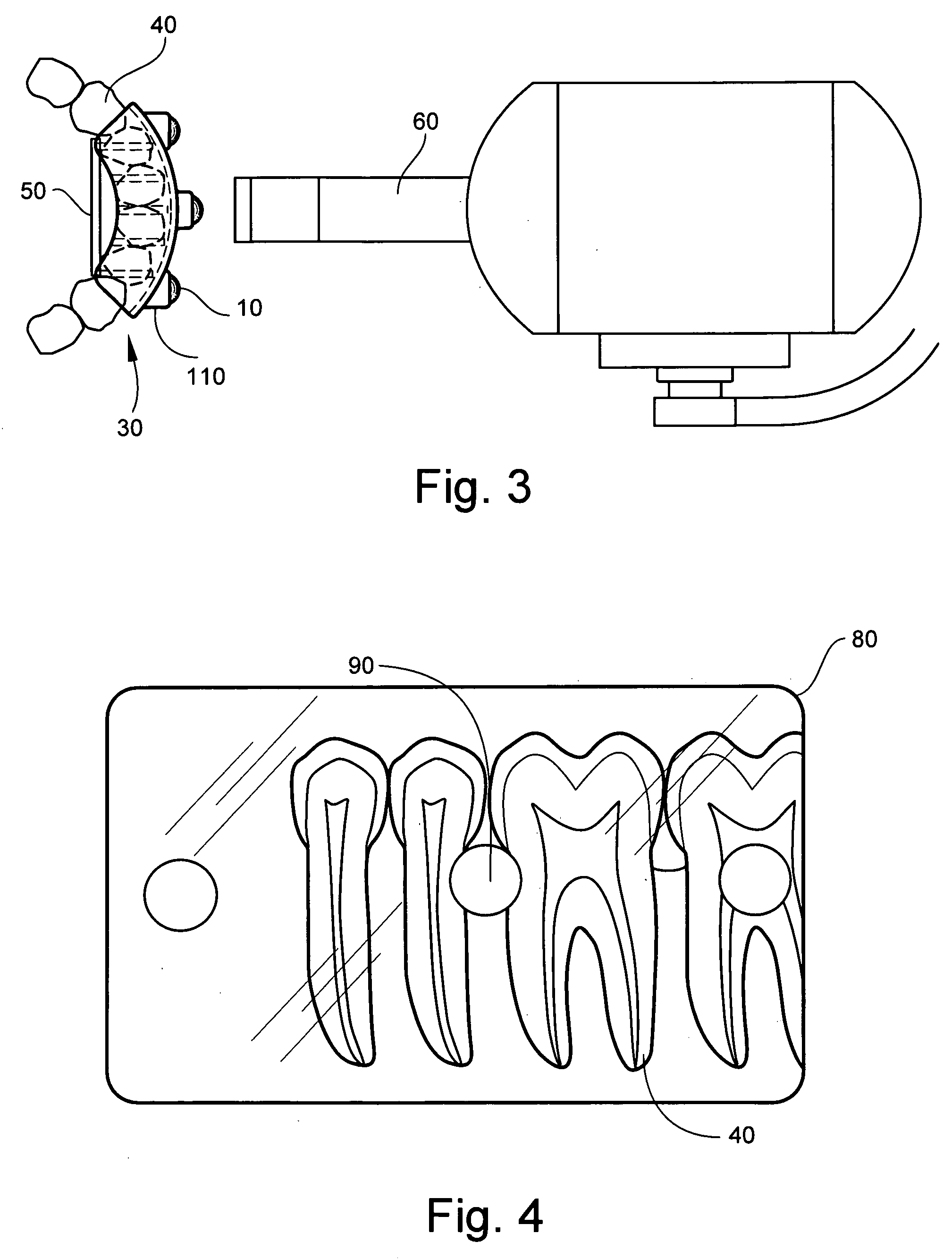 X-ray reference device and method of use